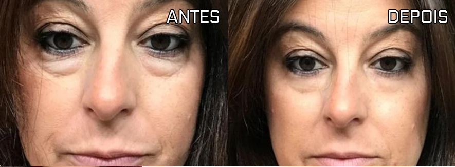 Antes e depois de Maria Santos