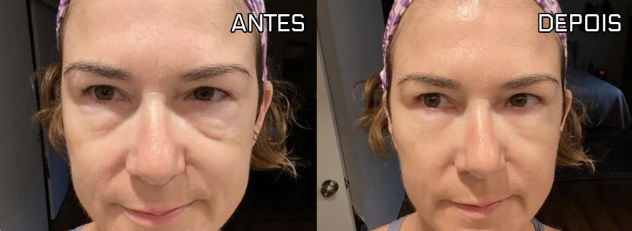 Antes e depois de Ana Paula