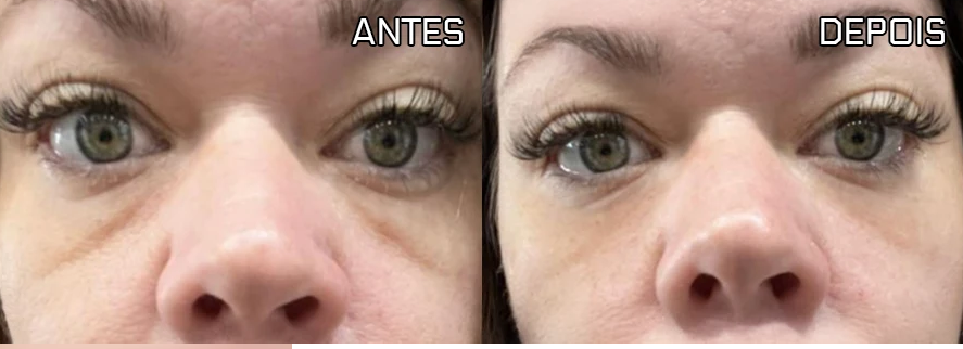 Antes e depois de Adriana Soares