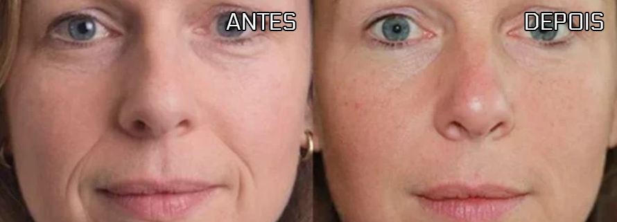 Antes e depois de Mariana